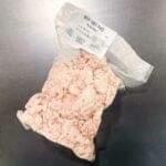 kidney fat